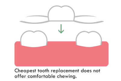 partial denture is the cheapest option to replace a tooth