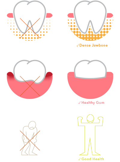 dental implant requirments