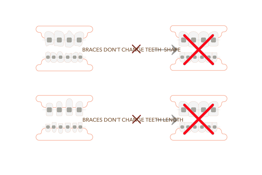 braces cannot fix teeth shapes and colors