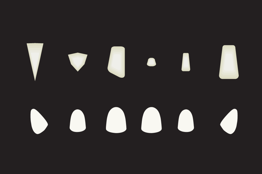 any tooth shape possible
