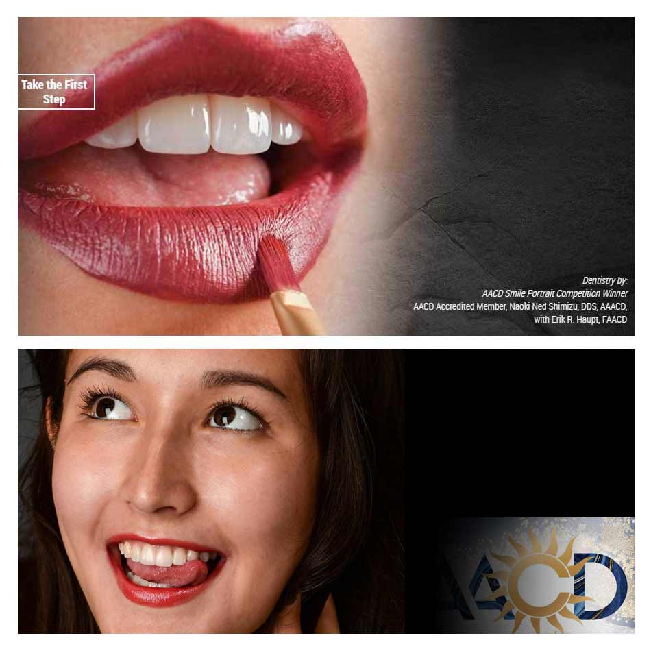 Imagine how porcelain veneers transform your smile