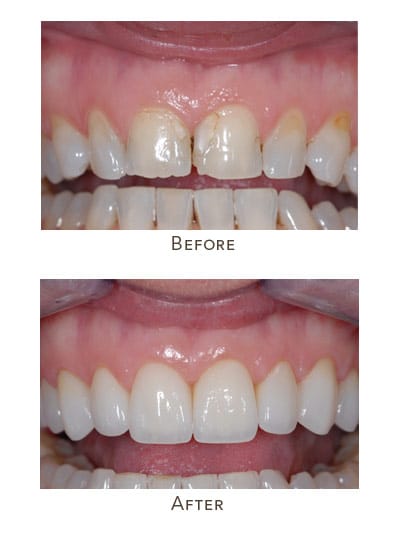 Before & After Image of Same Day Makeover West Houston TX