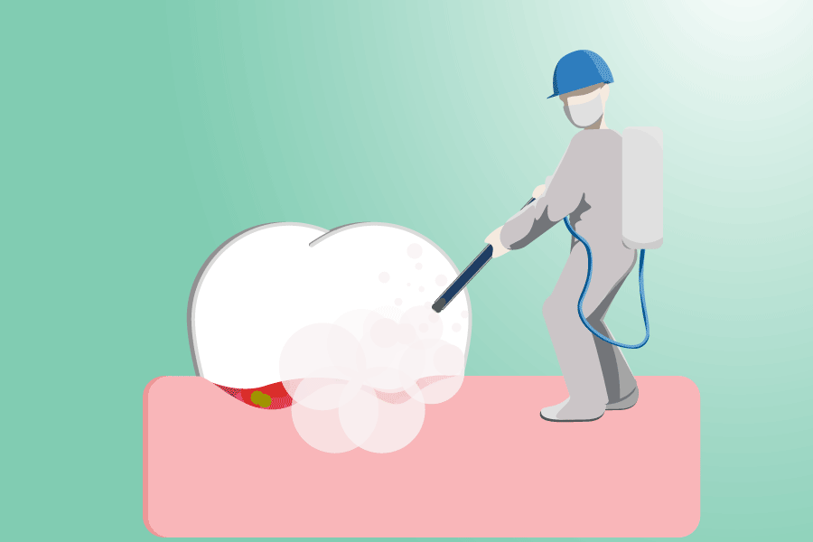 Periodontitis West Houston TX