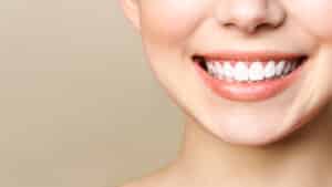 Close-up of young woman smiling with perfect white teeth, representing professional teeth whitening and oral care in modern dentistry.
