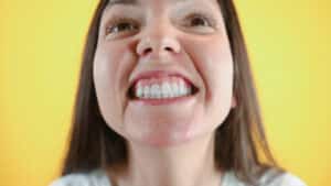 A young woman smiles broadly in a close-up image, revealing an uneven gumline and white teeth, highlighting the need for cosmetic dental care.