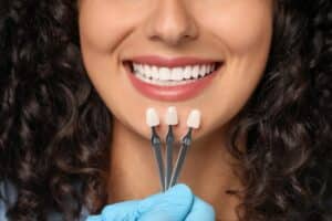 A dentist examines a young woman’s tooth shade up close to ensure proper color matching for dental veneers during a cosmetic dentistry consultation.