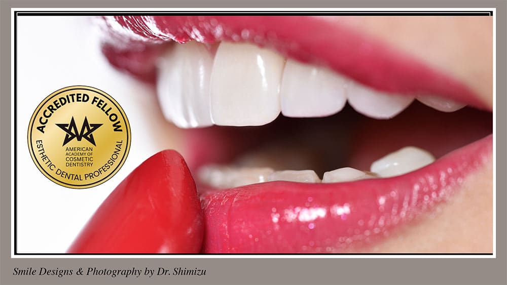 20th only SmileMakeoverPP Wide update16 slide 2