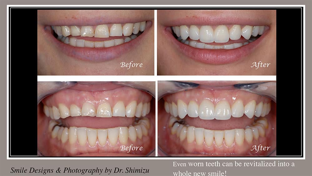 20th only SmileMakeoverPP Wide update16 slide 6