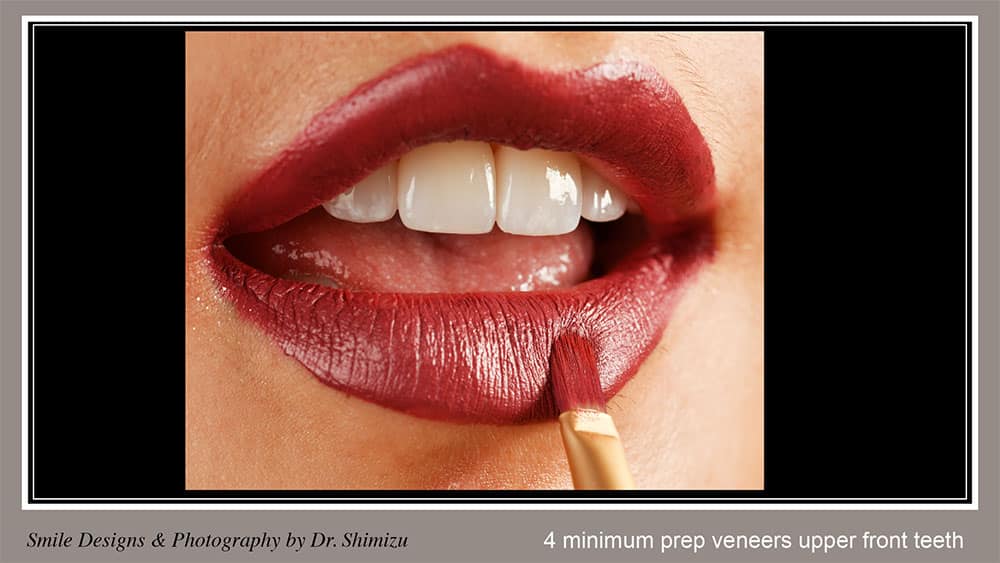 20th only SmileMakeoverPP Wide update16 slide 8