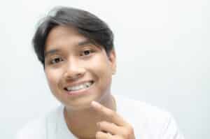 Young man smiling and showing crooked, overlapping teeth and bucktooth, isolated on white background, concept of orthodontic problems and dental correction